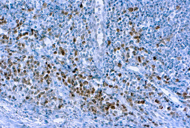 Caspase 3 Antibody in Immunohistochemistry (Paraffin) (IHC (P))