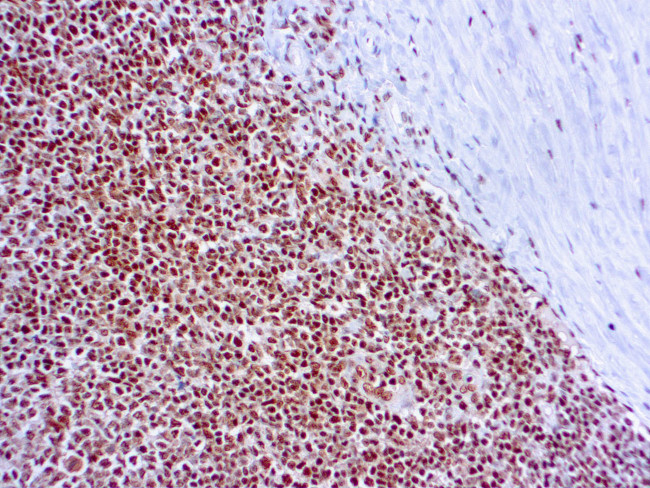 RPA2 Antibody in Immunohistochemistry (Paraffin) (IHC (P))