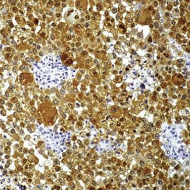 S100 Antibody in Immunohistochemistry (Paraffin) (IHC (P))