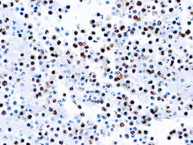 HHV-8 Antibody in Immunocytochemistry (ICC/IF)