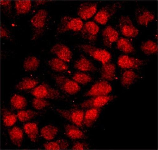 hnRNP A1 Antibody in Immunocytochemistry (ICC/IF)