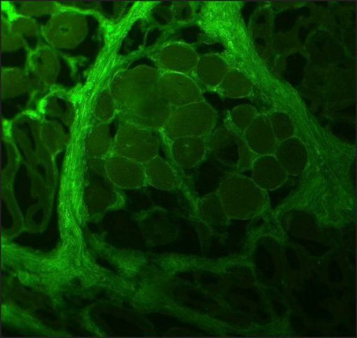 Collagen I Antibody in Immunohistochemistry (Frozen) (IHC (F))