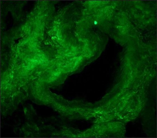 Collagen I Antibody in Immunohistochemistry (Frozen) (IHC (F))