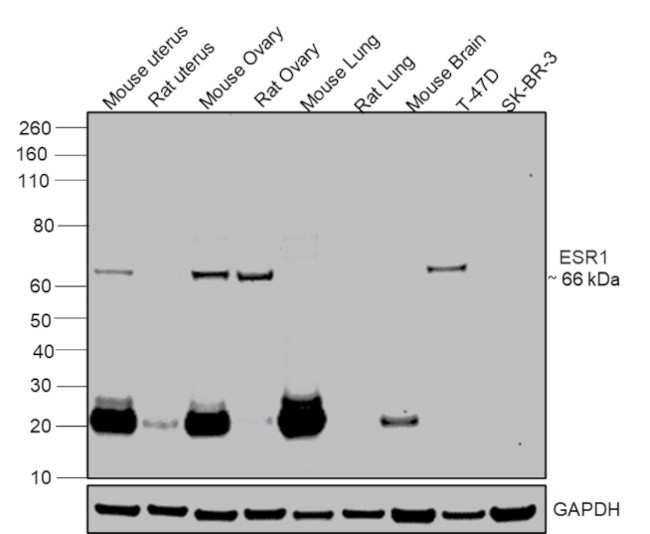 Estrogen Receptor alpha Antibody