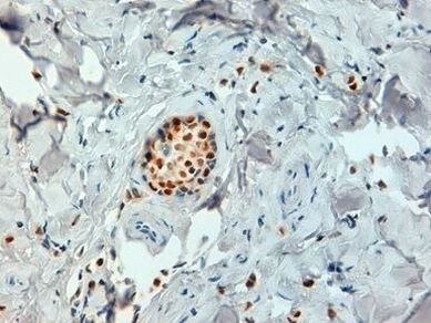 Estrogen Receptor alpha Antibody in Immunohistochemistry (Paraffin) (IHC (P))