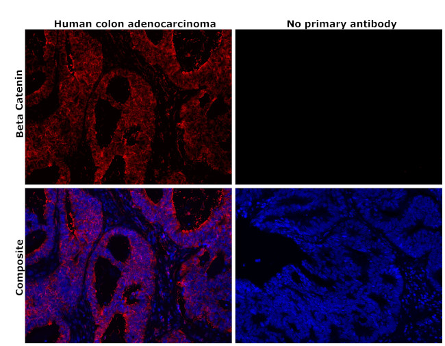 beta Catenin Antibody in Immunohistochemistry (Paraffin) (IHC (P))