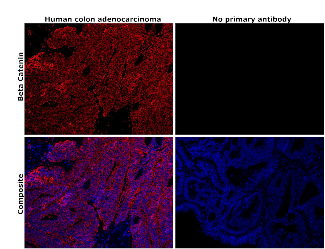 beta Catenin Antibody in Immunohistochemistry (Paraffin) (IHC (P))