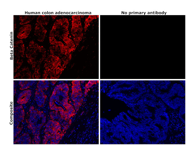 beta Catenin Antibody in Immunohistochemistry (Paraffin) (IHC (P))