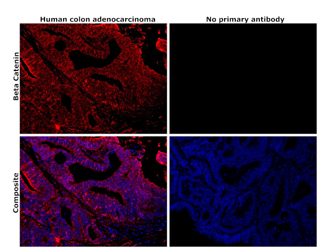 beta Catenin Antibody in Immunohistochemistry (Paraffin) (IHC (P))