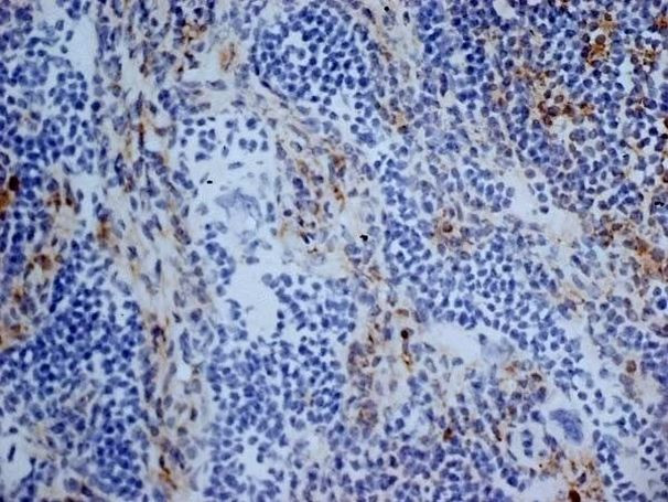 CD13 Antibody in Immunohistochemistry (Frozen) (IHC (F))