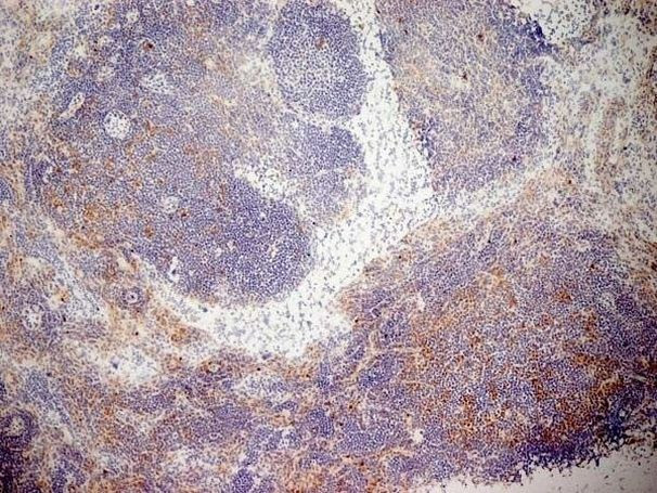 CD13 Antibody in Immunohistochemistry (Frozen) (IHC (F))