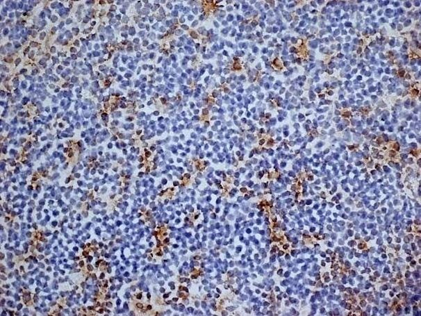 CD13 Antibody in Immunohistochemistry (Frozen) (IHC (F))