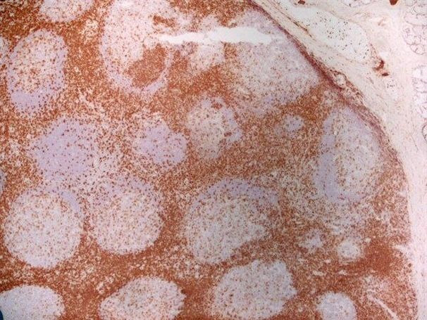 CD7 Antibody in Immunohistochemistry (Frozen) (IHC (F))