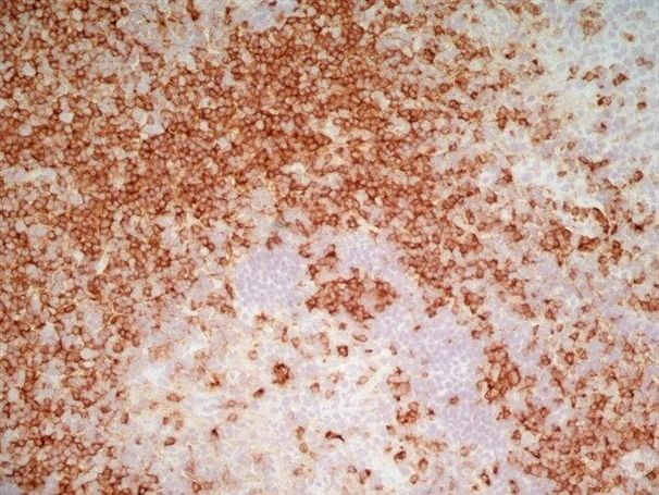 CD7 Antibody in Immunohistochemistry (Frozen) (IHC (F))