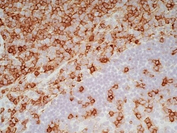 CD7 Antibody in Immunohistochemistry (Frozen) (IHC (F))