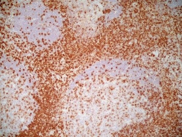 CD7 Antibody in Immunohistochemistry (Frozen) (IHC (F))