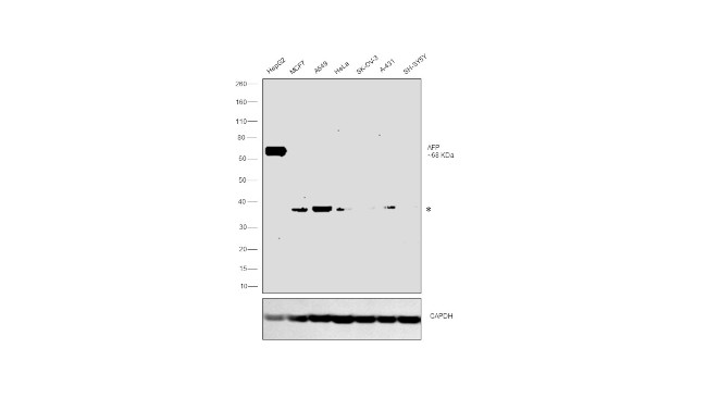 AFP Antibody