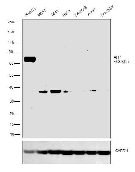 AFP Antibody in Western Blot (WB)