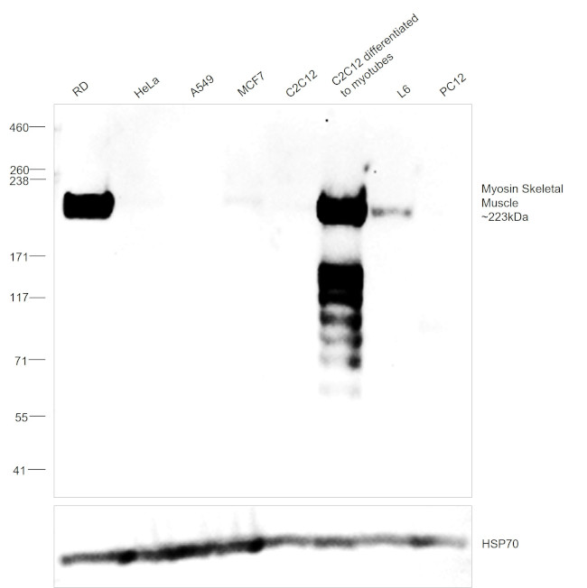 Myosin Skeletal Muscle Antibody in Western Blot (WB)