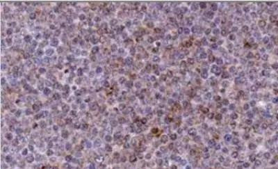 NOXA Antibody in Immunohistochemistry (Paraffin) (IHC (P))