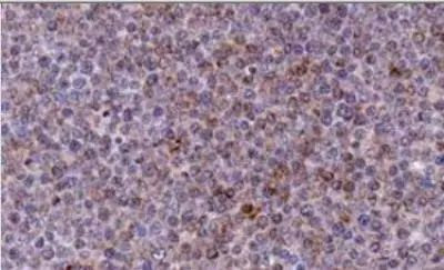 NOXA Antibody in Immunohistochemistry (Paraffin) (IHC (P))