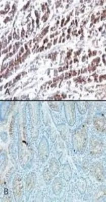 HTRA2 Antibody in Immunohistochemistry (Paraffin) (IHC (P))