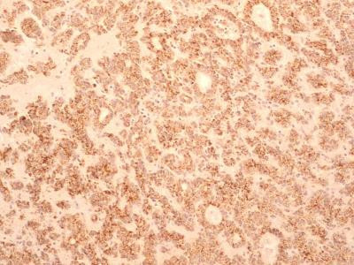 TEM8 Antibody in Immunohistochemistry (Paraffin) (IHC (P))