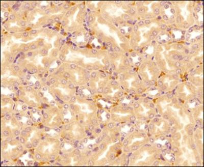 IL-25 Antibody in Immunohistochemistry (Paraffin) (IHC (P))