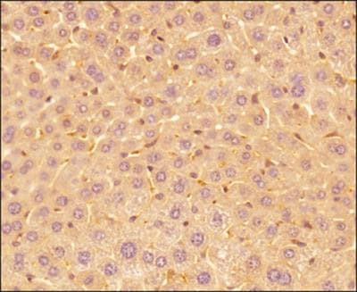 IL-25 Antibody in Immunohistochemistry (Paraffin) (IHC (P))