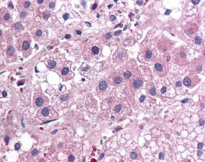 IL-25 Antibody in Immunohistochemistry (Paraffin) (IHC (P))