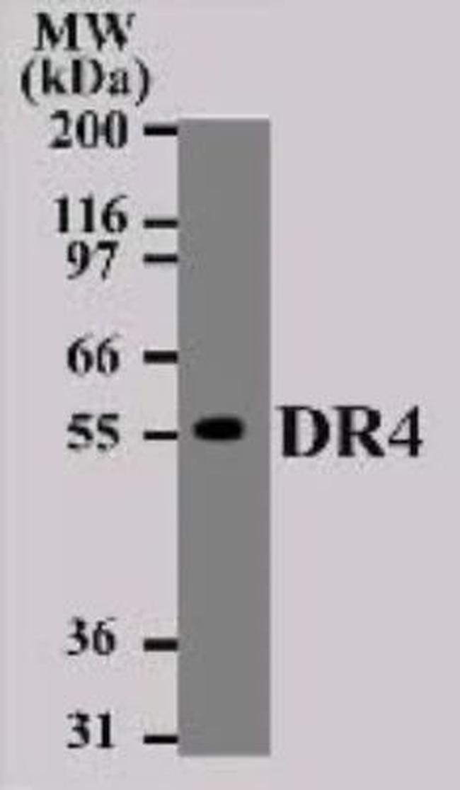 DR4 Antibody in Western Blot (WB)