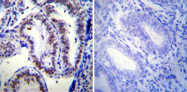 Progesterone Receptor Antibody in Immunohistochemistry (Paraffin) (IHC (P))