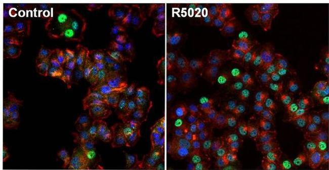 Progesterone Receptor Antibody