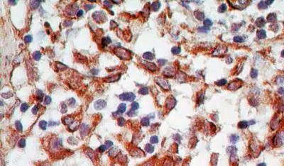 CD254 (RANK Ligand) Antibody in Immunohistochemistry (Paraffin) (IHC (P))