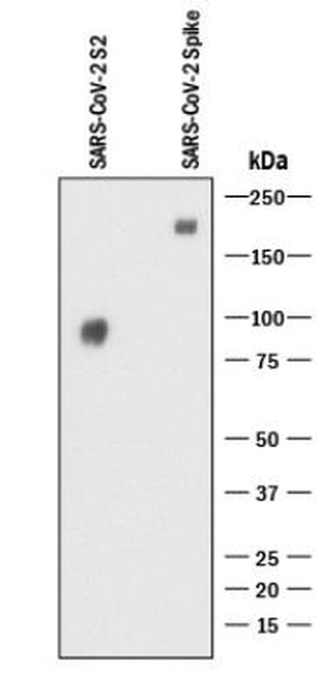 SARS Coronavirus Spike Protein Antibody in Western Blot (WB)