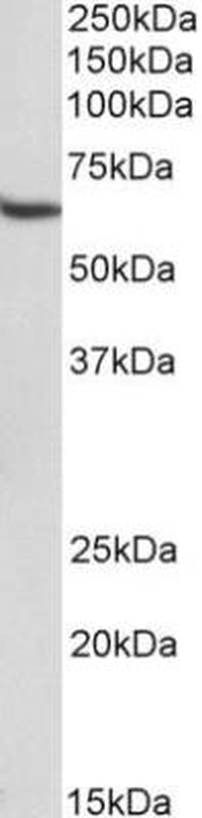 STAM Antibody in Western Blot (WB)