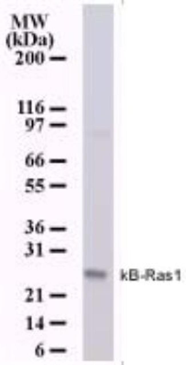 KappaB ras1 Antibody in Western Blot (WB)