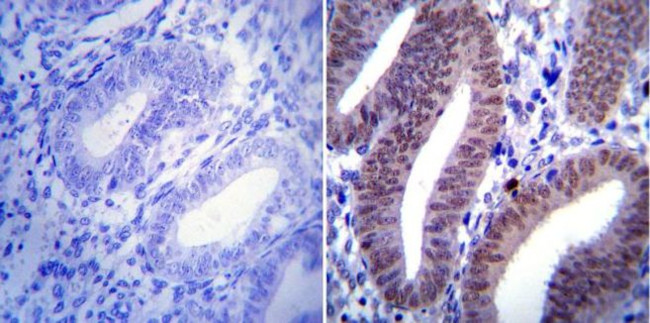 Progesterone Receptor Antibody in Immunohistochemistry (IHC)