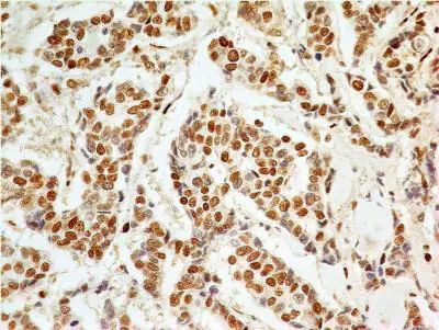 APIP Antibody in Immunohistochemistry (Paraffin) (IHC (P))