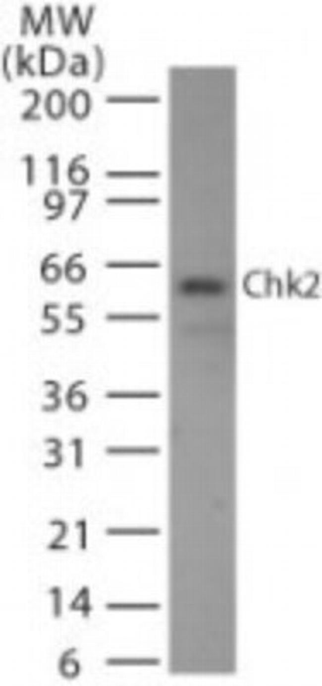 CHK2 Antibody in Western Blot (WB)