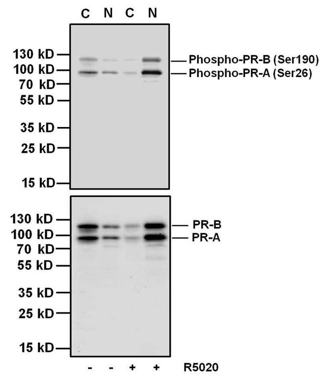 Phospho-Progesterone Receptor (Ser190) Antibody