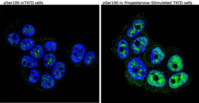 Phospho-Progesterone Receptor (Ser190) Antibody