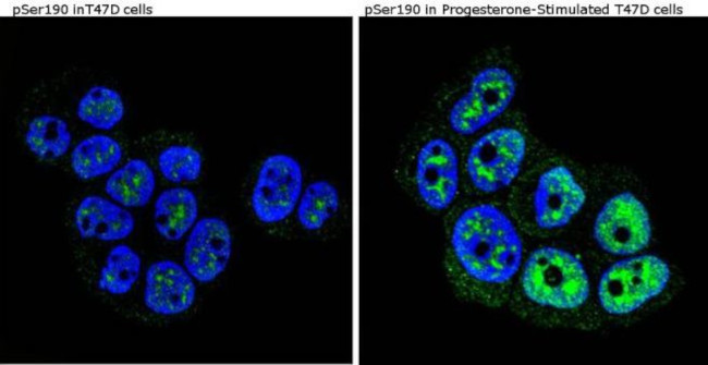 Phospho-Progesterone Receptor (Ser190) Antibody in Immunocytochemistry (ICC/IF)