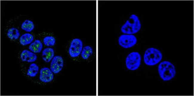 Phospho-Progesterone Receptor (Ser190) Antibody in Immunocytochemistry (ICC/IF)