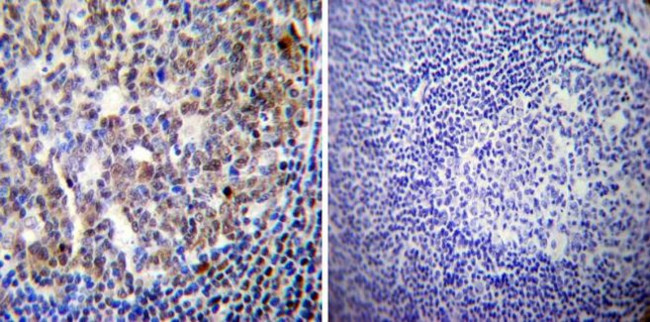 Phospho-Progesterone Receptor (Ser190) Antibody in Immunohistochemistry (Paraffin) (IHC (P))