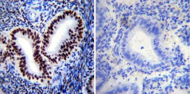 Phospho-Progesterone Receptor (Ser190) Antibody in Immunohistochemistry (Paraffin) (IHC (P))