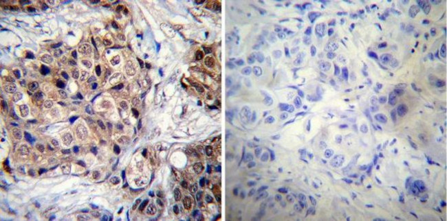 Phospho-Progesterone Receptor (Ser190) Antibody in Immunohistochemistry (Paraffin) (IHC (P))