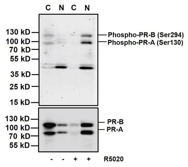 Phospho-Progesterone Receptor (Ser294) Antibody in Western Blot (WB)