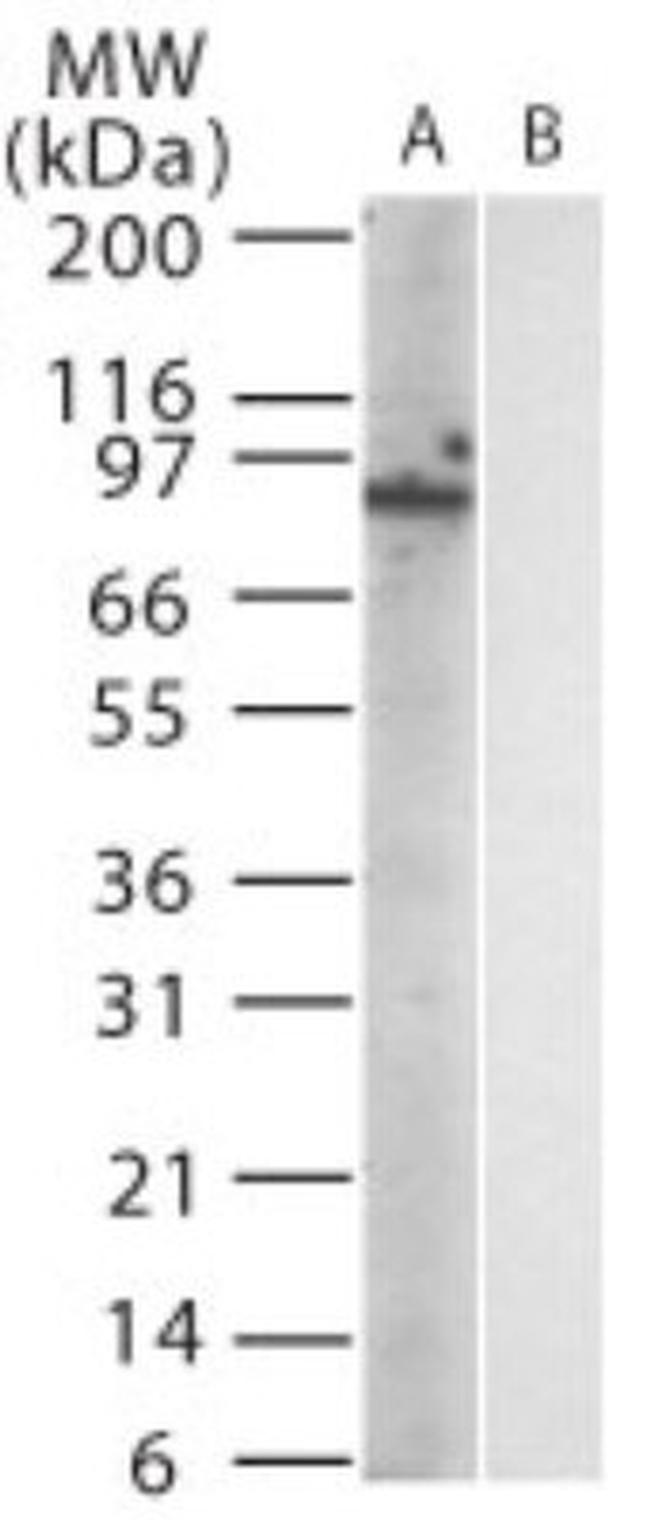 TLR12 Antibody in Western Blot (WB)