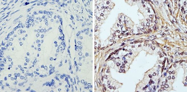 APE1 Antibody in Immunohistochemistry (Paraffin) (IHC (P))